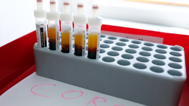Vzorky připravené na testování v laboratoři na přítomnost koronaviru
