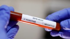Test na koronavirus (archivní foto)