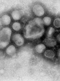 Virus chřipky A/H1N1