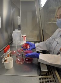 Výzkum bakterie EHEC v hamburské laboratoři