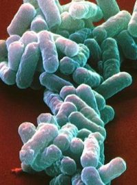 Enterohemoragické bakterie Escherichia coli (EHEC) na kolorovaném obrázku ze skenovacího elektronového mikroskopu, 5000x zvětšeno.