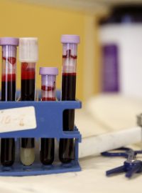Testování krve na přítomnost viru zika