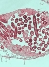 bakterie legionella (ilustrační foto)