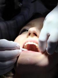 zub, zuby, zubař, zubní kaz, prohlídka, lékař, ústa